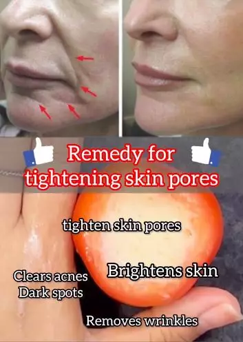 Kencangkan wajah kendur dan pori besar Berbagai sumber