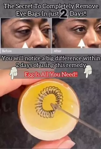 Kencangkan kerutan area kantung mata Berbagai sumber