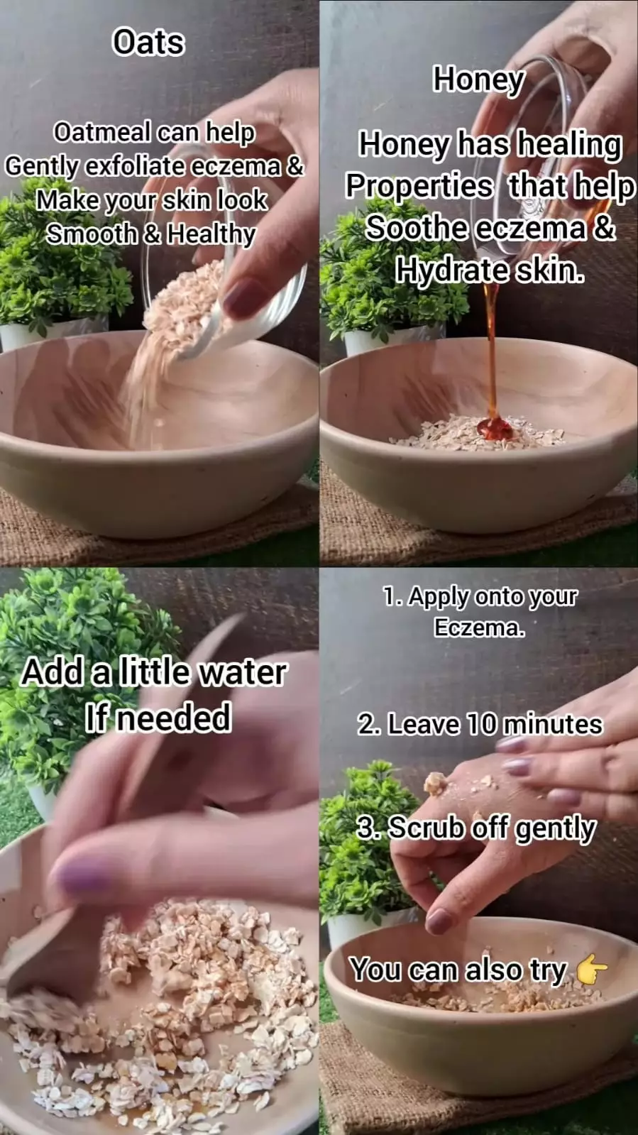 kering rentan gejala eksim © Instagram