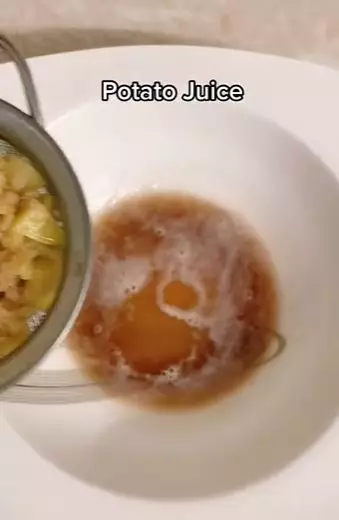 Hilangkan flek hitam di area pipi Berbagai sumber