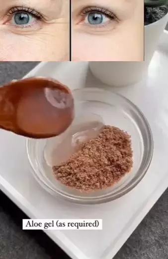 Atasi wajah kendur dan keriput pakai aloe vera Berbagai sumber Atasi wajah kendur dan keriput pakai aloe vera Berbagai sumber