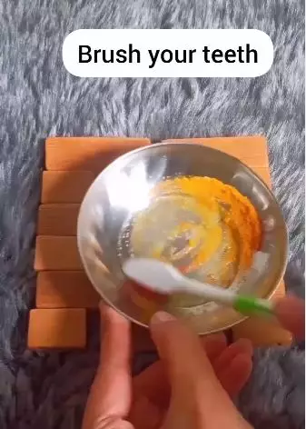 putihkan gigi kuning berbagai sumber putihkan gigi kuning berbagai sumber