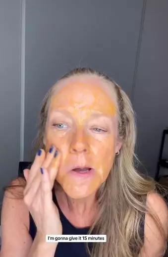 Cara atasi kerutan & wajah mengendur Berbagai sumber Cara atasi kerutan & wajah mengendur Berbagai sumber