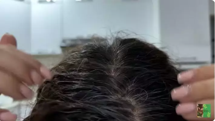 cara mengatasi uban prematur  berbagai sumber