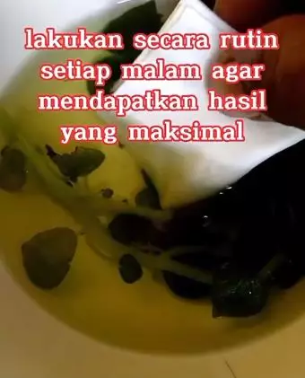 Sirih cina hempas komedo dan pori besar di wajah Berbagai sumber