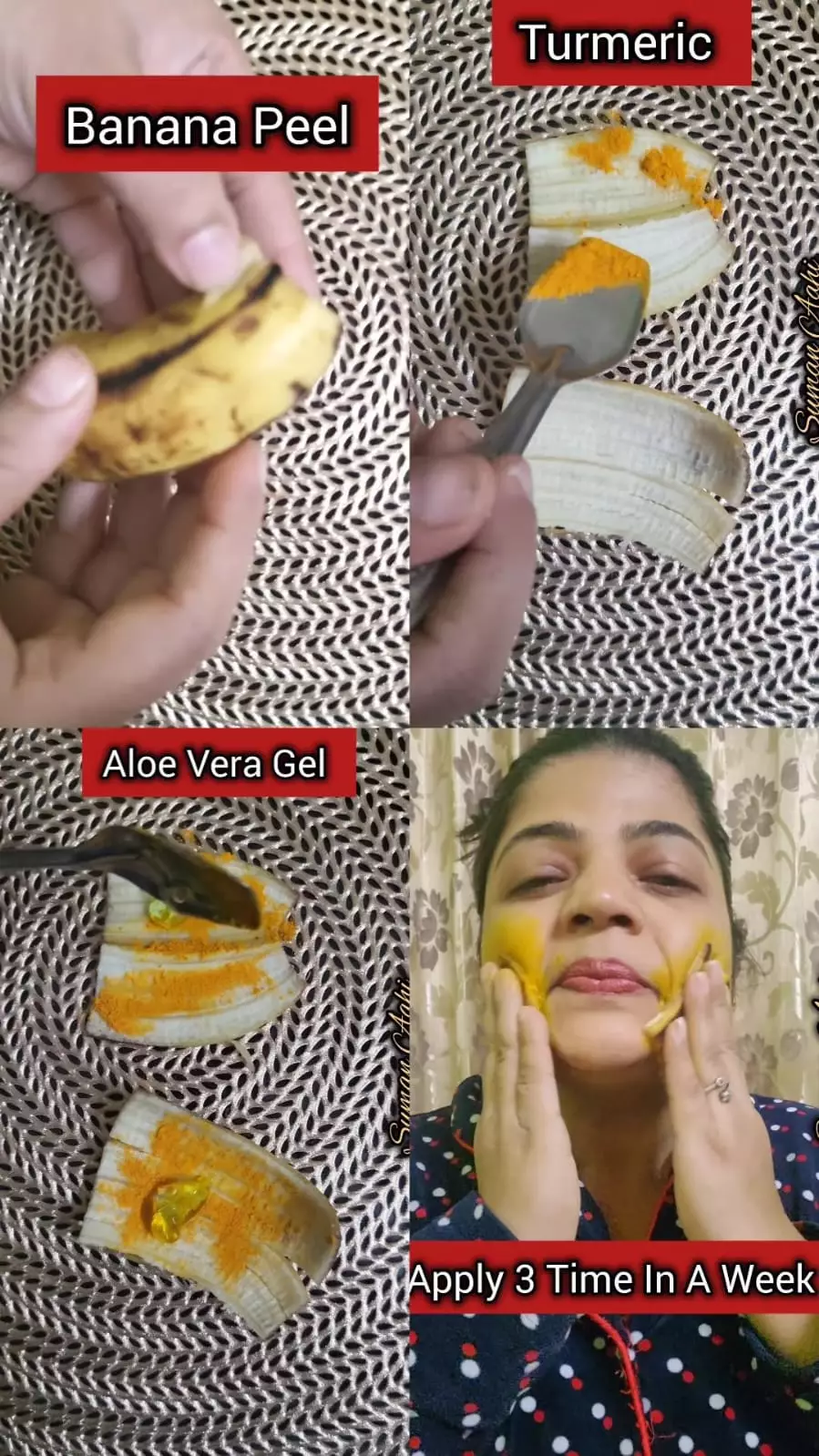 mengecil dan bebas jerawat © Instagram mengecil dan bebas jerawat © Instagram