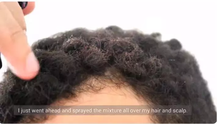 cara ampuh atasi rambut tipis berbagai sumber