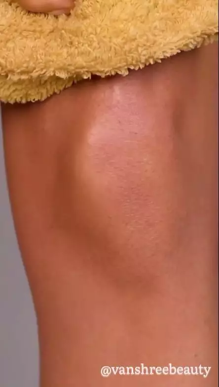 memutihkan lutut menghitam  berbagai sumber