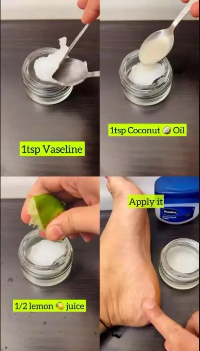 menghaluskan tumit kaki retak menghitam berbagai sumber menghaluskan tumit kaki retak menghitam berbagai sumber