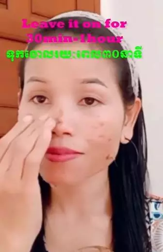 Bikin krim kolagen cegah wajah keriput  Berbagai sumber Bikin krim kolagen cegah wajah keriput  Berbagai sumber