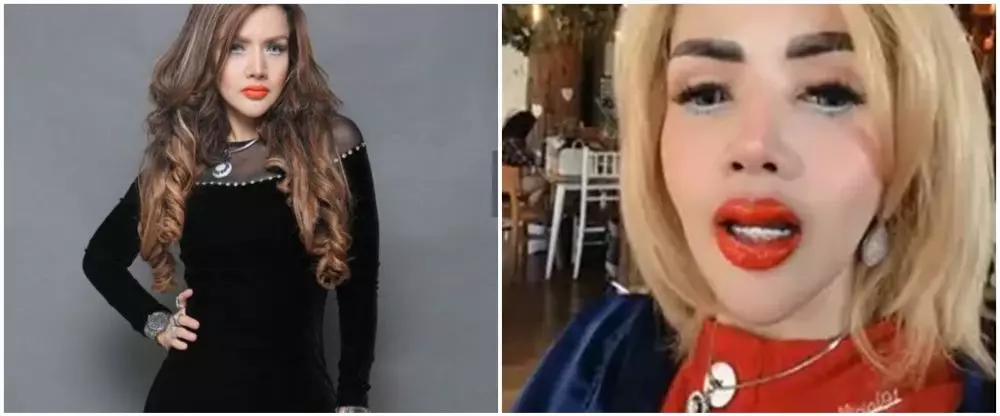 cerita seleb kena efek samping perawatan © instagram