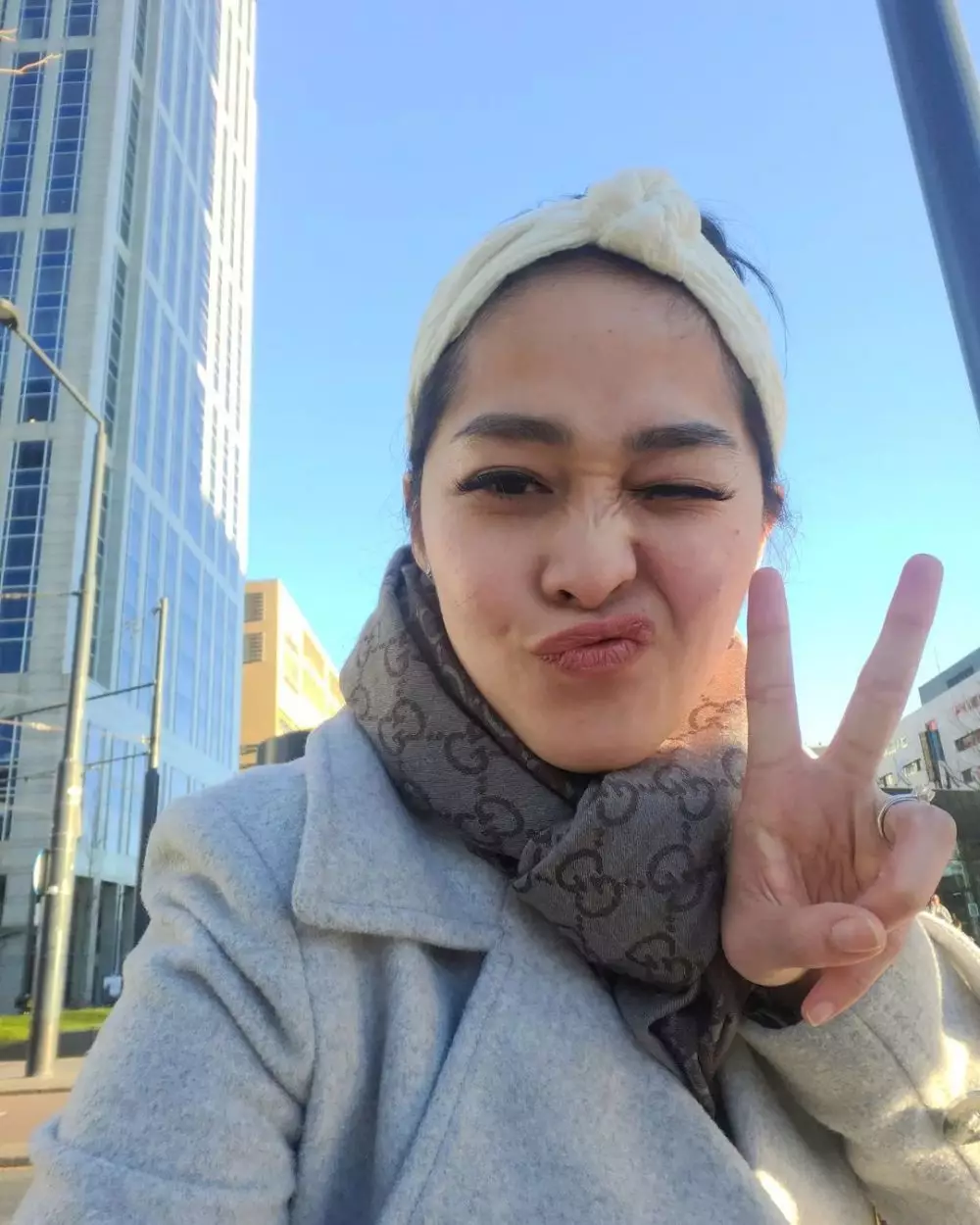 cerita seleb kena efek samping perawatan © instagram