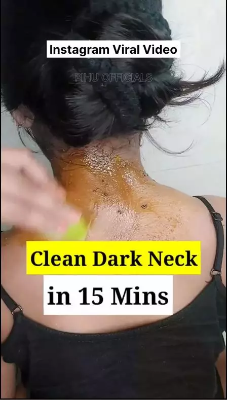 cara merontokkan daki hitam di leher berbagai sumber cara merontokkan daki hitam di leher berbagai sumber