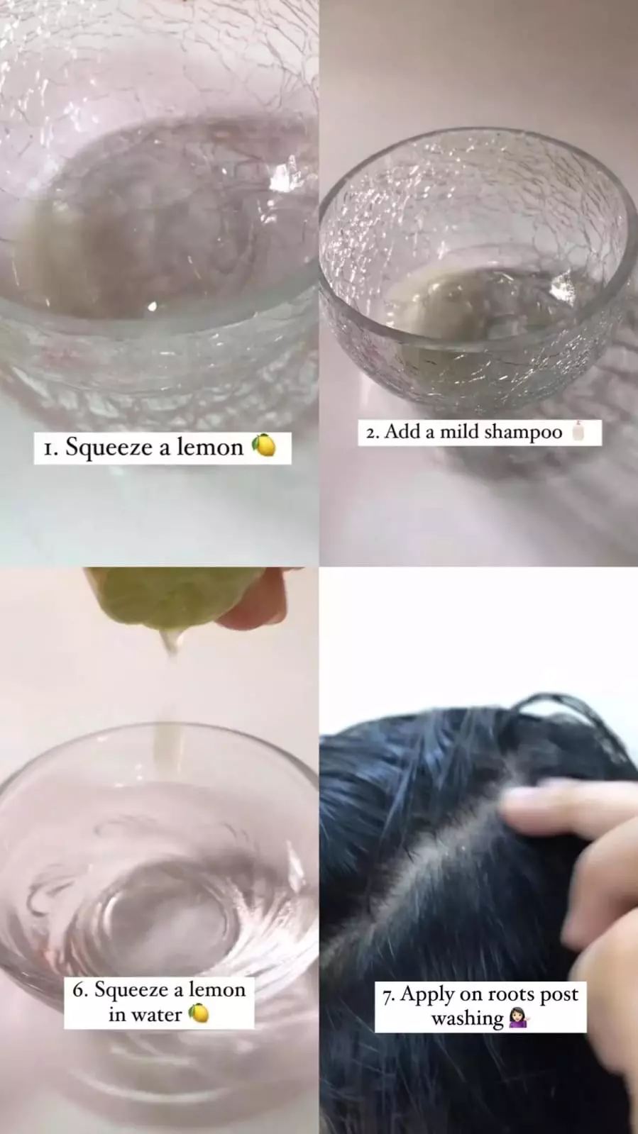 ketombe rasa gatal © Instagram