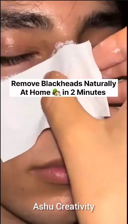 trik angkat komedo di hidung berbagai sumber trik angkat komedo di hidung berbagai sumber