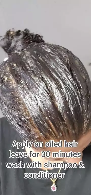 tingkatkan pertumbuhan rambut botak tengah berbagai sumber