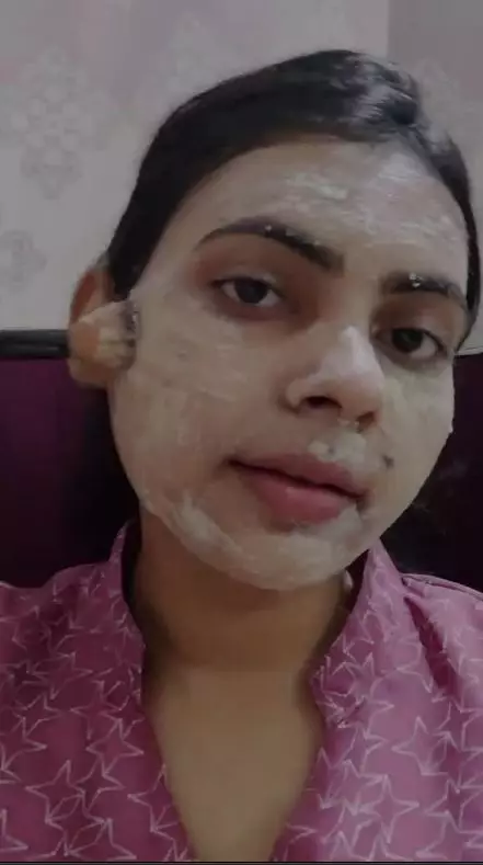 cara putihkan pigmentasi akibat sinar matahari berbagai sumber