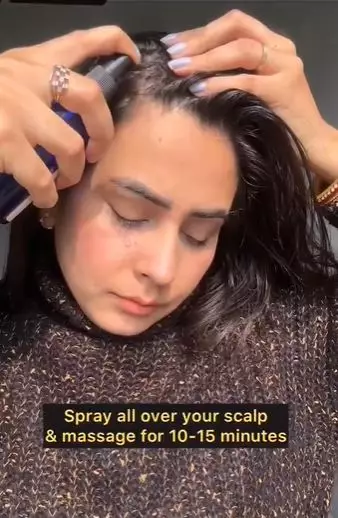 Trik atasi rontok dan kulit kepala kotor Berbagai sumber