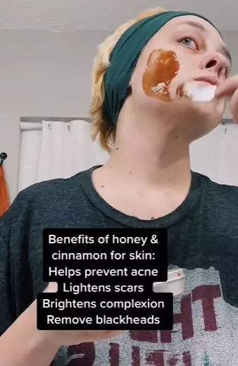 Atasi pori-pori besar akibat komedo di wajah Berbagai sumber