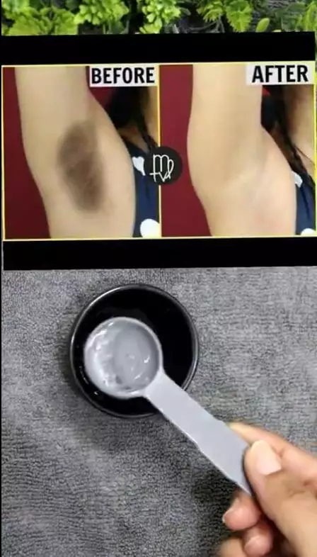 atasi ketiak menghitam dan berbau berbagai sumber