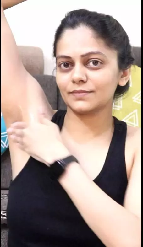 atasi ketiak menghitam dan berbau berbagai sumber