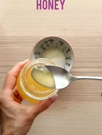 Atasi ketombe agar tak semakin banyak Berbagai sumber