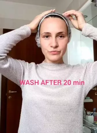 Atasi ketombe agar tak semakin banyak Berbagai sumber