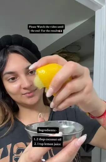 Atasi ketombe dan kulit kepala mengelupas Berbagai sumber