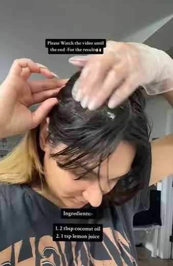 Atasi ketombe dan kulit kepala mengelupas Berbagai sumber