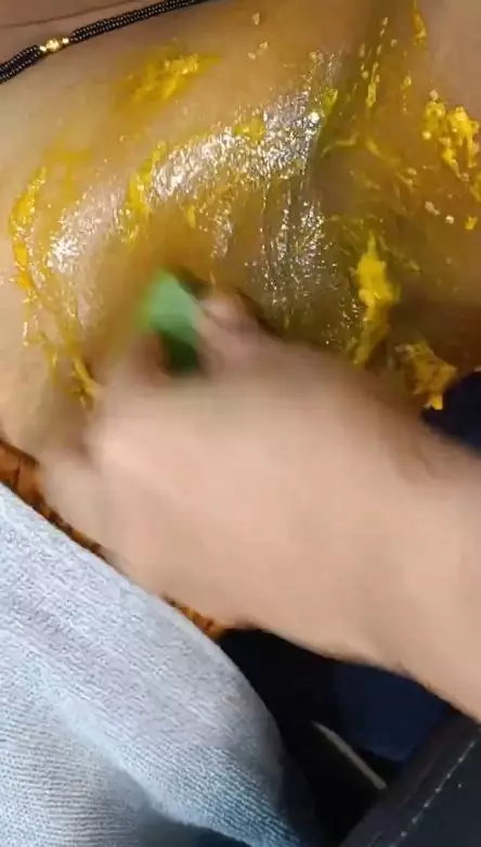 cerahkan kulit ketiak yang hitam pekat. berbagai sumber