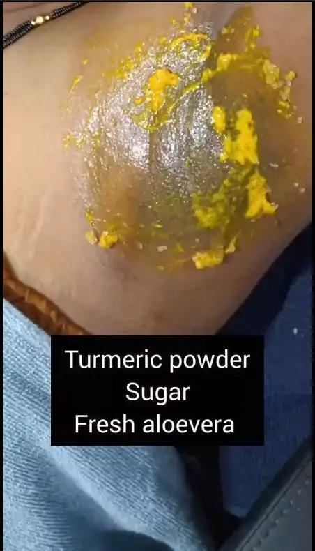 cerahkan kulit ketiak yang hitam pekat. berbagai sumber