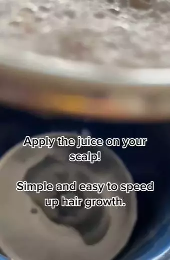 Bawang merah untuk rambut tipis dan sulit panjang Berbagai sumber Bawang merah untuk rambut tipis dan sulit panjang Berbagai sumber