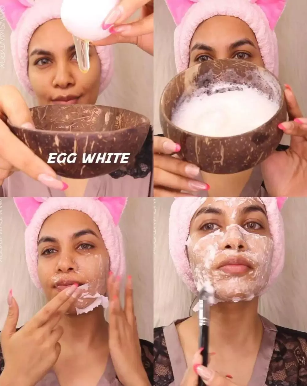 komedo dan minyak © Instagram