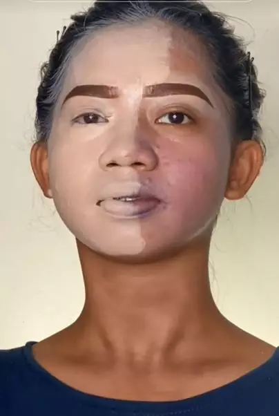 Transformasi makeup wajah wanita penuh jerawat berbagai sumber Transformasi makeup wajah wanita penuh jerawat berbagai sumber