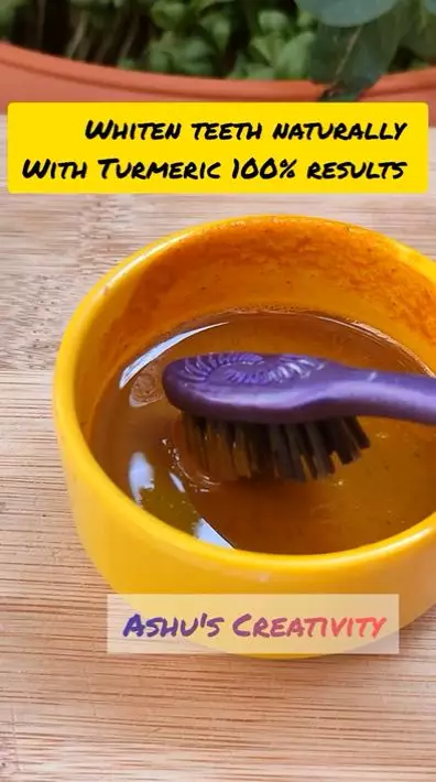 cara memutihkan gigi kuning. berbagai sumber cara memutihkan gigi kuning. berbagai sumber