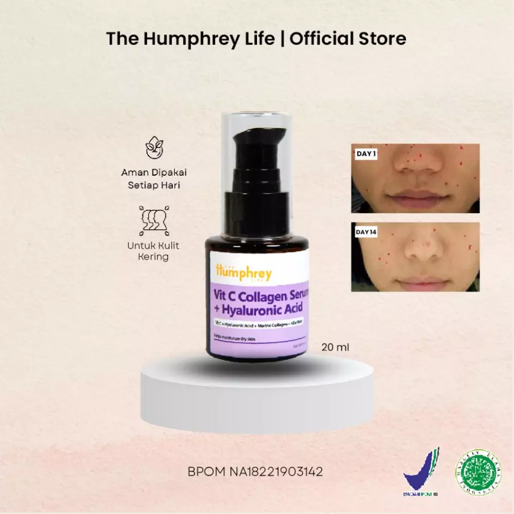 Rekomendasi serum skincare kolagen berbagai sumber