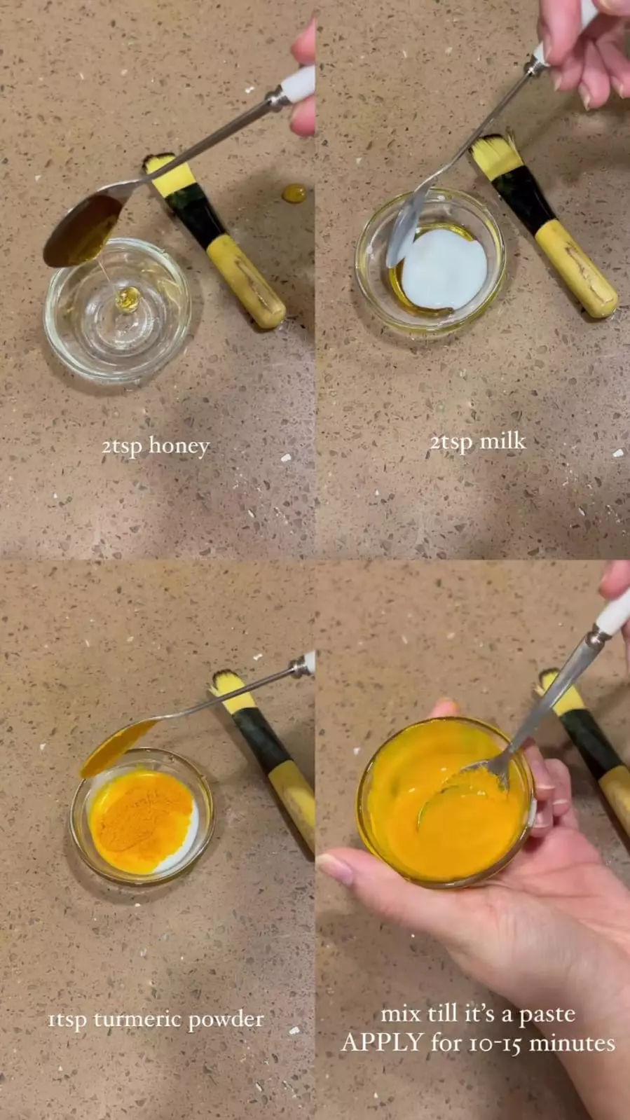 pori kotoran penyebab © Instagram