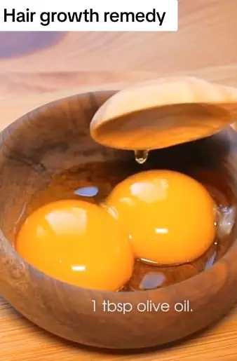 Bikin rambut tumbuh lebat dan antirontok Berbagai sumber