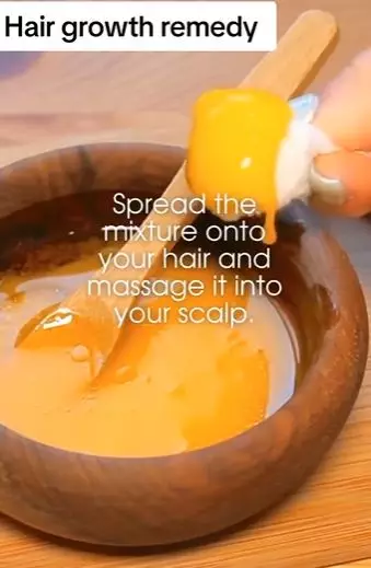 Bikin rambut tumbuh lebat dan antirontok Berbagai sumber