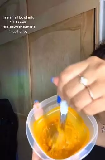 Hiperpigmentasi ketiak hitam Berbagai sumber