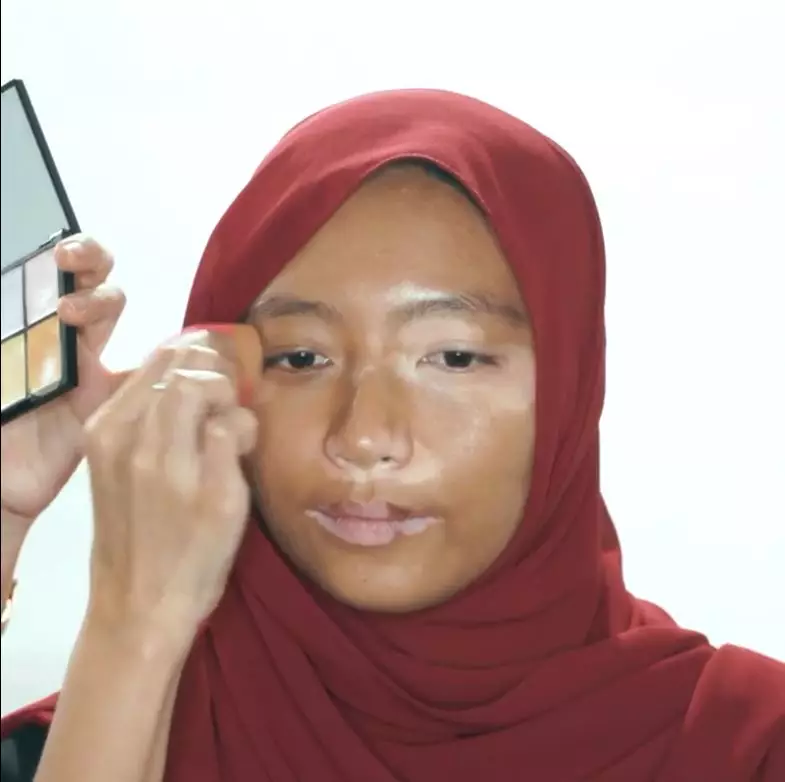 makeup wanita wajah polos dengan vitiligo berbagai sumber