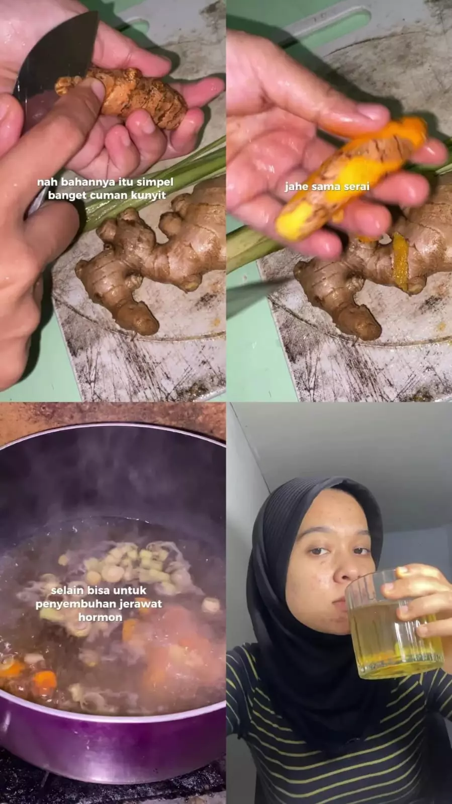 lihat wajah berjerawat © Instagram lihat wajah berjerawat © Instagram