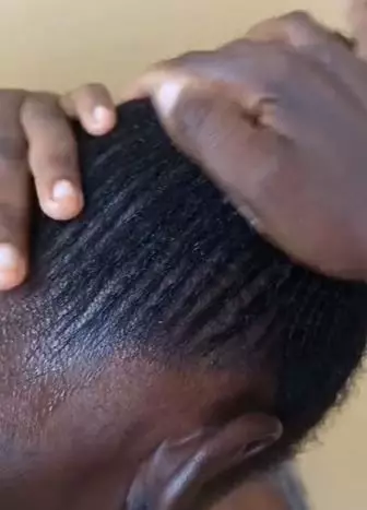 Hempas ketombe dan gatal di kepala Berbagai sumber