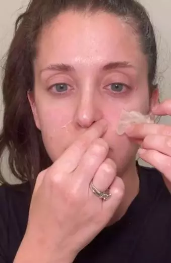 Gelatin atasi komedo hidung TikTok