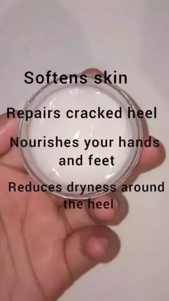 Tumit kaki kering dan pecah-pecah agar mulus Berbagai sumber