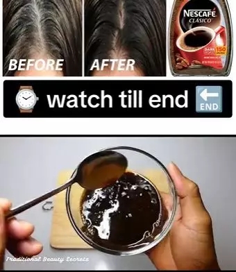 Uban kembali hitam secara alami Berbagai sumber