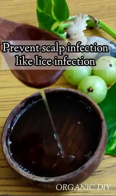 mencegah munculnya rambut beruban berbagai sumber