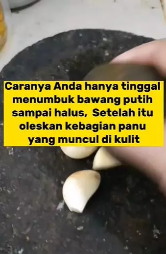 Atasi panu ala wanita paruh baya Berbagai sumber