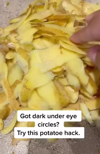 Atasi kantung mata hitam wanita paruh baya Berbagai sumber