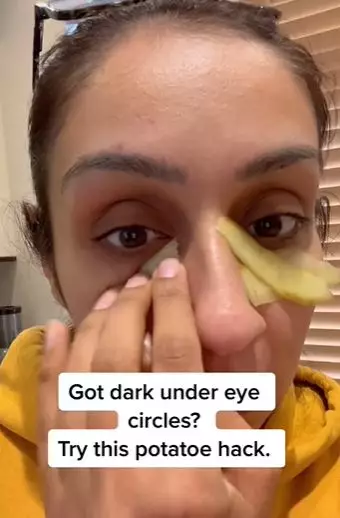 Atasi kantung mata hitam wanita paruh baya Berbagai sumber